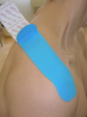 kinesiotape supraespinoso