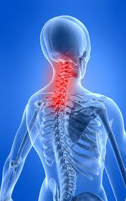 dolor cervical