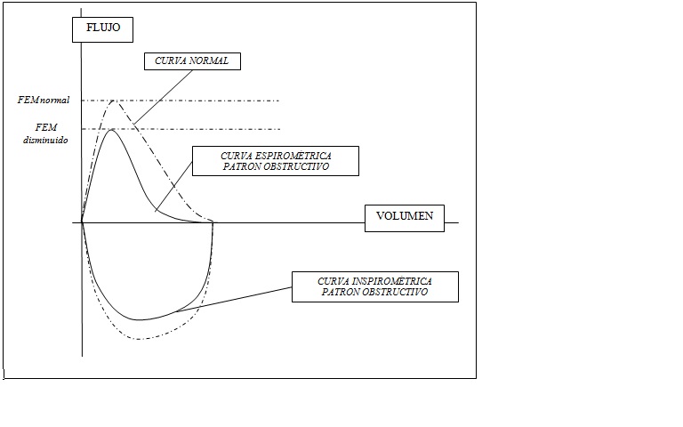 espirometria simple sd obstructivo